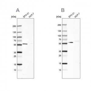 Anti-PDP1 antibody produced in rabbit HPA021152-100UL
