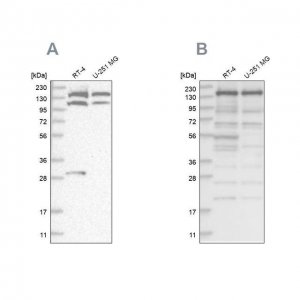 Anti-PDS5A antibody produced in rabbit 