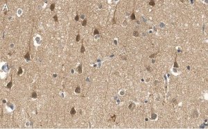 Anti-PEA15 Antibody, clone 2J13 ZooMAb� Rabbit Monoclonal 