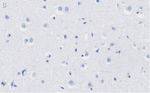 Anti-PEA15 Antibody, clone 2J13 ZooMAb� Rabbit Monoclonal 