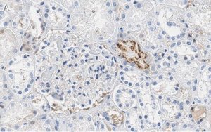 Anti-PEDF (SERPIN F1) Antibody, clone 2C16 ZooMAb� Rabbit Monoclonal 