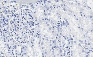 Anti-PEDF (SERPIN F1) Antibody, clone 2C16 ZooMAb� Rabbit Monoclonal 