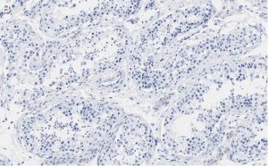 Anti-PER2 Antibody, clone 1G17 ZooMAb� Rabbit Monoclonal 