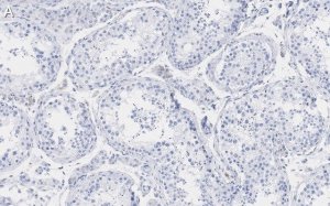 Anti-Pericentrin Antibody, clone 2H11, ZooMAb� Rabbit Monoclonal 
