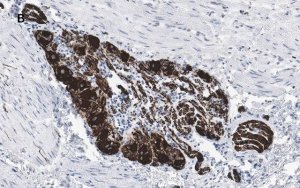 Anti-Peripherin Antibody, clone 1D4, ZooMAb� Rabbit Monoclonal 