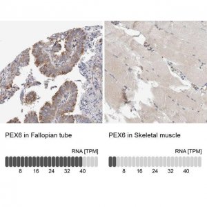 Anti-PEX6 antibody produced in rabbit 