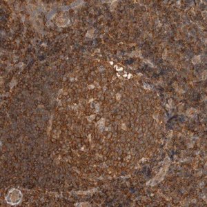 Anti-PFDN4 antibody produced in rabbit HPA024055-100UL