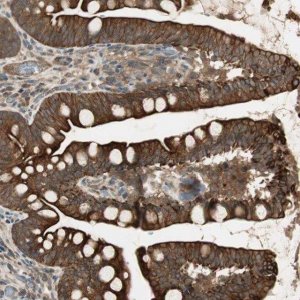 Anti-PFDN5 antibody produced in rabbit HPA008587-100UL