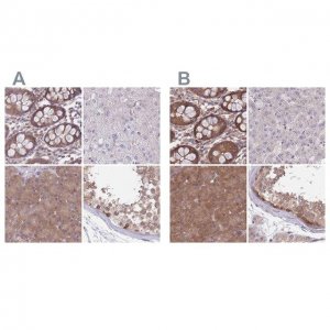 Anti-PFDN6 antibody produced in rabbit 