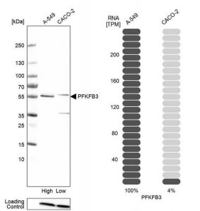 Anti-PFKFB3 antibody produced in rabbit 
