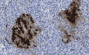 Anti-PGP9.5/UCHL1 Antibody, clone 3C13 ZooMAb� Rabbit Monoclonal 