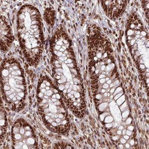 Anti-PHF23 antibody produced in rabbit 