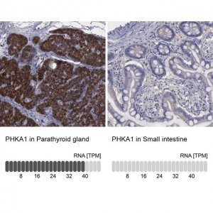 Anti-PHKA1 antibody produced in rabbit 