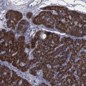 Anti-PHKA1 antibody produced in rabbit 