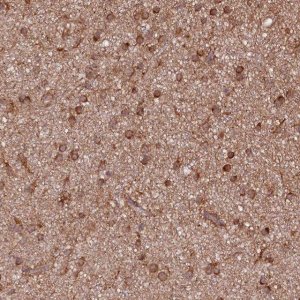 Anti-PHLDB1 antibody produced in rabbit 