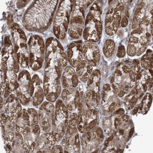 Anti-PHLDB2 antibody produced in rabbit 