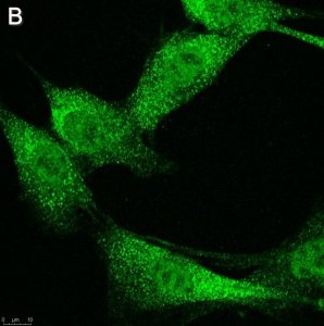 Anti-phospho-IRE-1 (Ser724) Antibody, clone 1M2 ZooMAb� Rabbit Monoclonal 