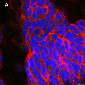 Anti-phospho-TrkB (Tyr816) Antibody, clone 2C21 ZooMAb� Rabbit Monoclonal 