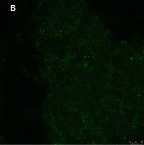 Anti-phospho-TrkB (Tyr816) Antibody, clone 2C21 ZooMAb� Rabbit Monoclonal 