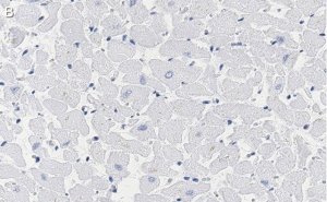 Anti-Phospholamban Antibody, clone 4J16 , ZooMAb� Rabbit Monoclonal 