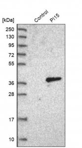 Anti-PI15 antibody produced in rabbit HPA006593-100UL