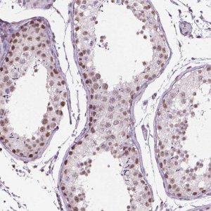 Anti-PIAS2 antibody produced in rabbit 