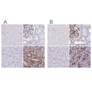 Anti-PITPNM3 antibody produced in rabbit 