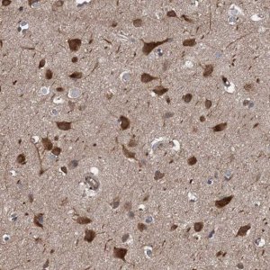 Anti-PJA2 antibody produced in rabbit 