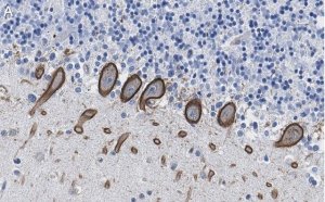 Anti-PKC Antibody, clone 1C13 ZooMAb� Rabbit Monoclonal 