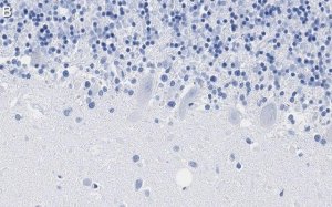 Anti-PKC Antibody, clone 1C13 ZooMAb� Rabbit Monoclonal 