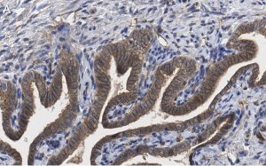 Anti-PKC Antibody, clone 1J13 ZooMAb� Rabbit Monoclonal 