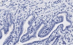 Anti-PKC Antibody, clone 1J13 ZooMAb� Rabbit Monoclonal 
