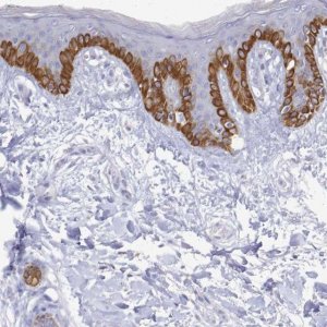 Anti-PLA2G4E antibody produced in rabbit 