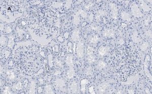 Anti-PLA2R1 Antibody, clone 1D5, ZooMAb� Rabbit Monoclonal 