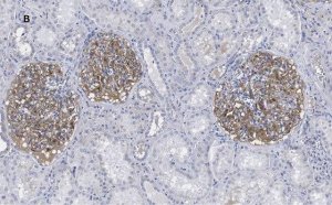 Anti-PLA2R1 Antibody, clone 1D5, ZooMAb� Rabbit Monoclonal 