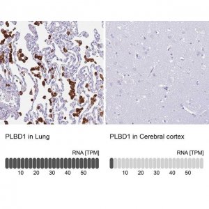 Anti-PLBD1 antibody produced in rabbit 