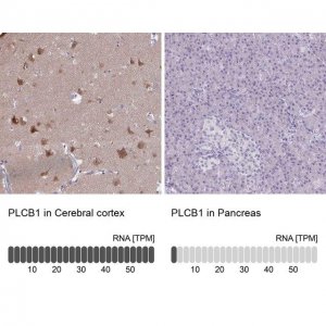 Anti-PLCB1 antibody produced in rabbit 