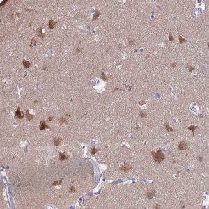 Anti-PLCB1 antibody produced in rabbit 