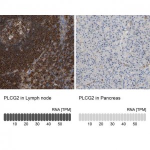 Anti-PLCG2 antibody produced in rabbit 
