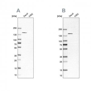 Anti-PLCG2 antibody produced in rabbit 