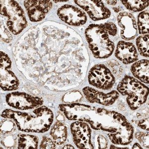 Anti-PLCL1 antibody produced in rabbit 