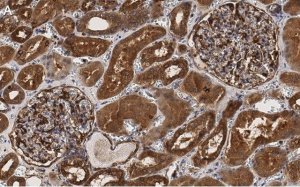 Anti-PLD2 Antibody, clone 6F13 ZooMAb� Rabbit Monoclonal 