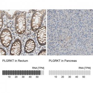 Anti-PLGRKT antibody produced in rabbit 