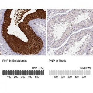 ANTI-PNP antibody produced in rabbit 