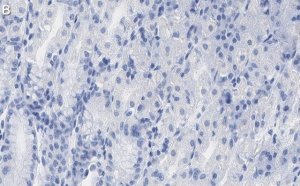 Anti-PNPT1 Antibody, clone 2D23 ZooMAb� Rabbit Monoclonal 