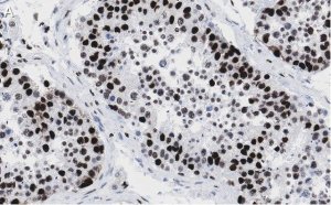 Anti-POLR2A Antibody, clone 3G21 ZooMAb� Rabbit Monoclonal 