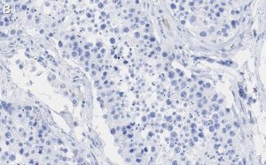 Anti-POLR2A Antibody, clone 3G21 ZooMAb� Rabbit Monoclonal 