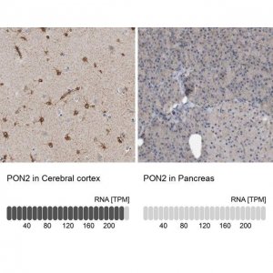 Anti-PON2 antibody produced in rabbit HPA029193-100UL