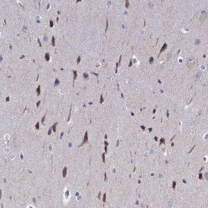 Anti-POP7 antibody produced in rabbit 