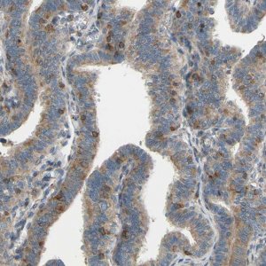 Anti-POR antibody produced in rabbit 